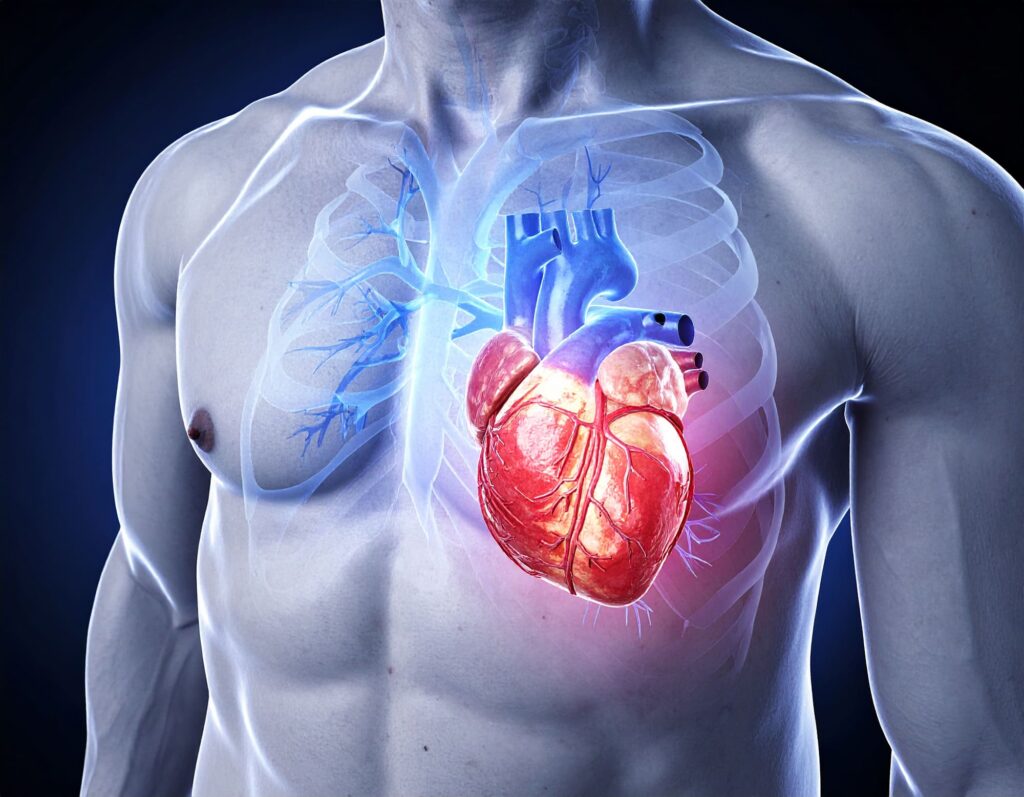 Causes de l'arrêt cardiaque