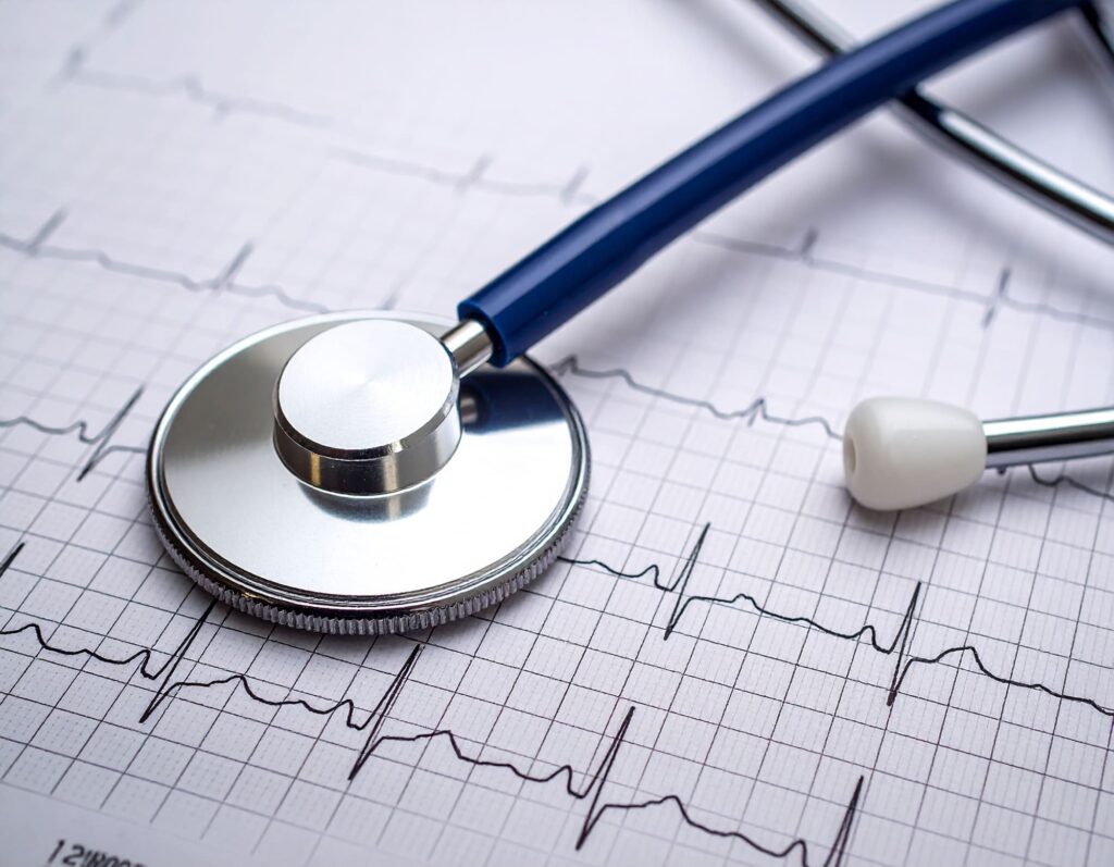 Crise cardiaque